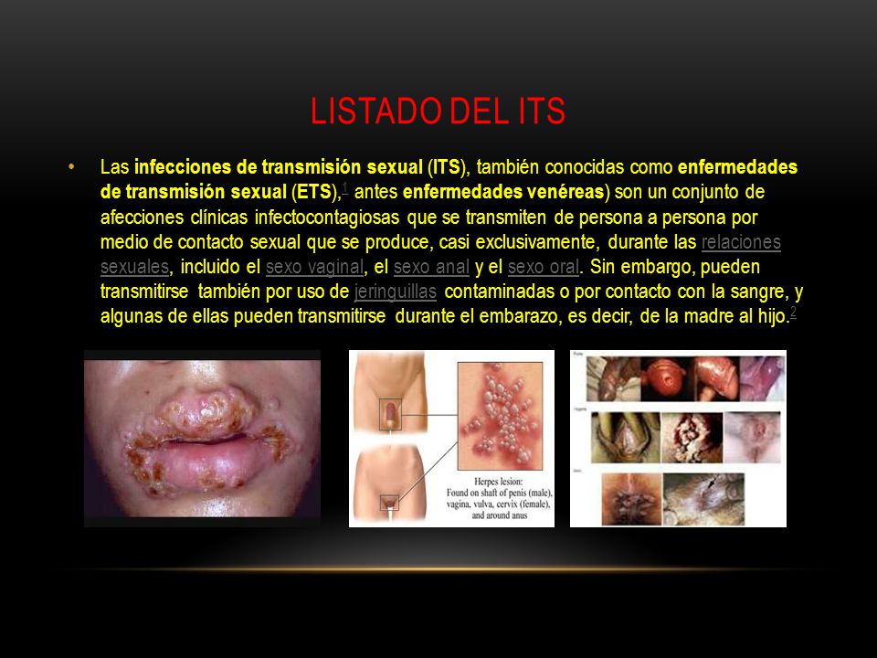 todas las enfermedades de transmision sexualidad lista